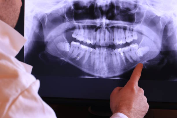 Best Emergency Dental Care for Broken or Chipped Teeth in Chesapeake Ranch Estates, MD