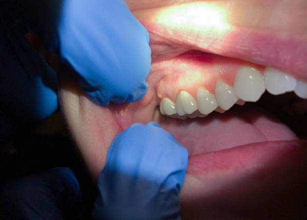 Best Emergency TMJ Treatment in Chesapeake Ranch Estates, MD